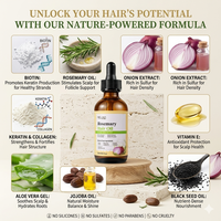 Aceite Natural de Romero y Cebolla con Biotina para el Crecimiento Rápido del Cabello, Tratamiento Anticaída, Suero para el Cuero Cabelludo, para Hombres y Mujeres