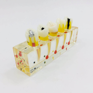 Riparazione della polpa dentale modello orale per la visualizzazione e la comunicazione - Product Image 3