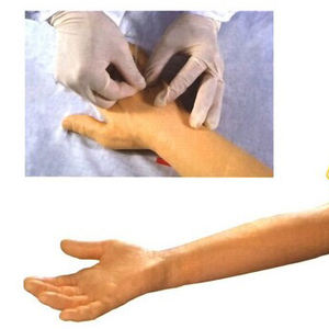 Ada โมเดลแขนพีวีซีสำหรับการฝึกแบบเจาะทะลุของผู้สูงอายุขั้นสูงพร้อมโมดูลการฉีดกล้ามเนื้อแบบสวมใส่ได้สำหรับการเรียนการสอน - Product Image 6