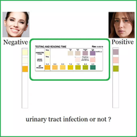 Bandelettes de test UTI, kit de test d'infection urinaire, détection des leucocytes, du pH et des nitrites, manuel, classe II, certifié CE, utilisation à domicile et en milieu hospitalier