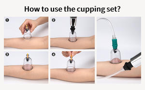 Nhà Máy bán hàng trực tiếp duy nhất hijama ly bán buôn Chất lượng cao ướt giác hơi trị liệu giá cả cạnh tranh bán buôn - Product Image 6