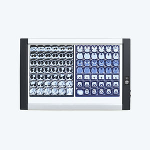 Micare DQ-2B Led <span class=keywords><strong>X</strong></span>-<span class=keywords><strong>Ray</strong></span> <span class=keywords><strong>Film</strong></span> <span class=keywords><strong>Viewer</strong></span> Auto Lightning Radiographic Testing <span class=keywords><strong>X</strong></span> <span class=keywords><strong>Ray</strong></span> Flaw Detect <span class=keywords><strong>Film</strong></span> <span class=keywords><strong>Viewer</strong></span> - Product Image 4