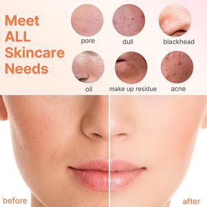 Facial Cleansing <b>Brush</b> Face Scrubber Exfoliator Wash Cleansing Exfoliating Powered Electric <b>Brushes</b> Spin Cleanser Cleaning <b>Scrub</b> - Product Image 2