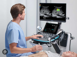 Ecógrafo Doppler Color Mindray Resona I8, Sistema de Diagnóstico por Ultrasonido 4D con Monitor LED de Alta Resolución de 23.8 Pulgadas para Uso Veterinario - Product Image 6