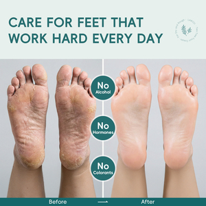 <span class=keywords><strong>Crème</strong></span> pour les <span class=keywords><strong>pieds</strong></span> à l'arbre à thé LAIKOU, soin rajeunissant des <span class=keywords><strong>pieds</strong></span>, soin doux des <span class=keywords><strong>pieds</strong></span>, peau rugueuse et craquelée, hydratation profonde, <span class=keywords><strong>crème</strong></span> pour le corps, les jambes, les coudes, 60g - Product Image 3