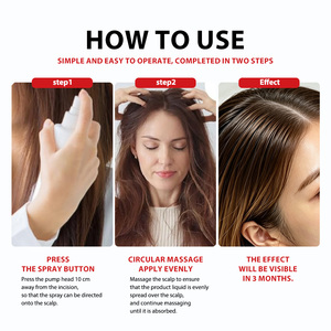 Spray Inhibidor de Androgenos al 5% para Mujeres, Extra Fuerte, con Romero y Biotina para el Crecimiento del Cabello y la Caída Hormonal del Cabello - Product Image 5