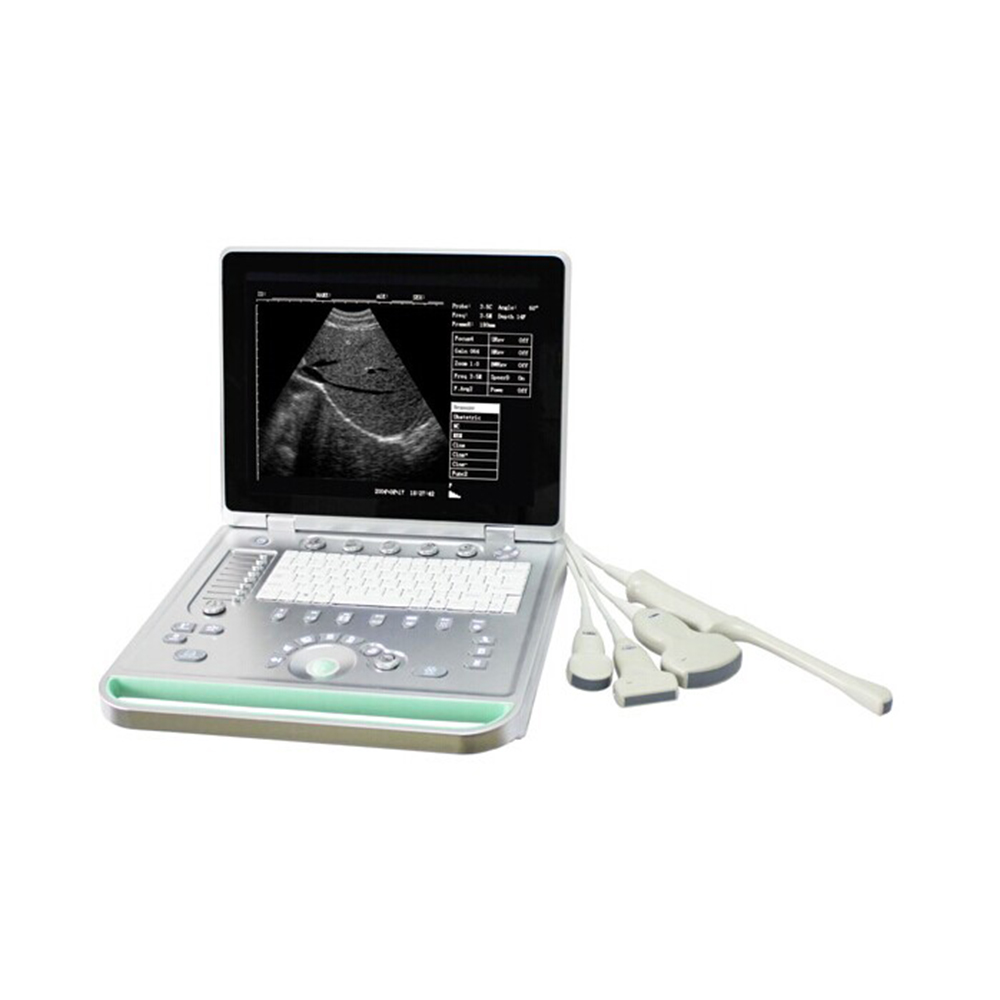 edan ultrasound