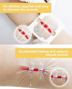 चिकित्सकीय घाव बंद करने वाला उपकरण सर्जिकल चिपकने वाला ज़िप सिलाई घाव बंद जिपर हटाने का निशान - Product Image 4
