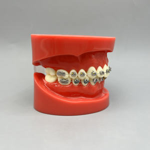 โมเดลฟันเรซินพร้อมลวดจัดฟันและลวดสลิงสำหรับอุปกรณ์ทันตกรรมแหล่งพลังงานด้วยตนเอง - Product Image 2