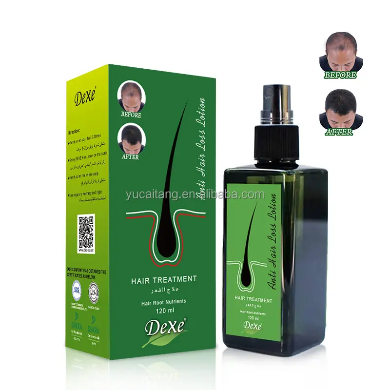 Dexe spray de crescimento capilar, herbal, crescimento do cabelo, masculino e feminino, atacado, anti perda de cabelo