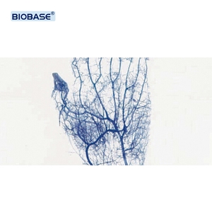 Biobase tĩnh mạch Finder phòng thí nghiệm tĩnh mạch xem hệ thống Illuminator xách tay tĩnh mạch Finder cho phòng thí nghiệm - Product Image 2