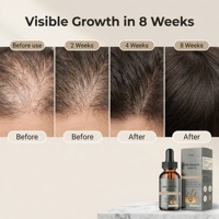 Sérum capillaire au peptide liposomique à base d'extraits végétaux naturels, soin nourrissant doux pour le cuir chevelu, certifié GMPC, OEM, marque privée, USA