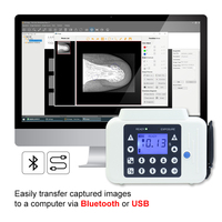 Système d'imagerie intra-orale numérique R1/R2 Capteur dentaire USB Capteurs intra-oraux numériques portables pour clinique dentaire