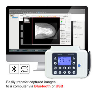 Système d'imagerie <span class=keywords><strong>intra</strong></span>-orale numérique R1/R2 Capteur dentaire <span class=keywords><strong>USB</strong></span> Capteurs <span class=keywords><strong>intra</strong></span>-oraux numériques portables pour clinique dentaire - Product Image 5