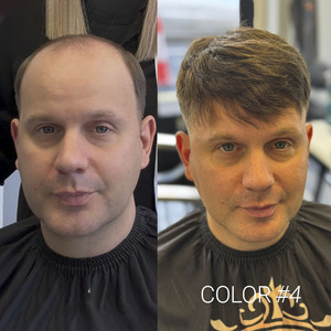 Protesi Capillare Maschile Newtimes Hair, Sistema di Sostituzione <span class=keywords><strong>Capelli</strong></span> Umani <span class=keywords><strong>Veri</strong></span>, Toupet per <span class=keywords><strong>Uomo</strong></span> - Product Image 6