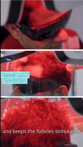 Dispositivo de crecimiento de cabello con láser de diodo 424 para <span class=keywords><strong>alopecia</strong></span> androgenética CE EE. UU. 510K Salón aprobado y clínicas de Dermatología - Product Image 2