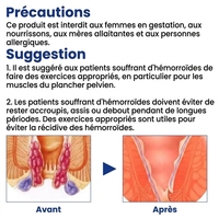 YanHe YHZCG-001 Crème Anti-Hémorroïdes Originale à Base d'Herbes Naturelles, Haute Efficacité, pour Usage Interne et Externe, Certifiée CE 2