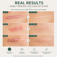Gel cicatrisant au silicone 100 % biologique à marque privée pour cicatrices chirurgicales, blessures et brûlures, pour cicatrices neuves et anciennes, validé par des essais cliniques