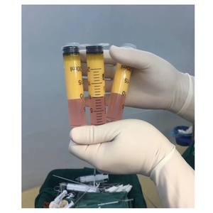 באיכות גבוהה גזע תא שומן העברת צנטריפוגה עבור 20cc 50cc מזרקים lipo יניקה טיפול יופי מרפאת שימוש - Product Image 6