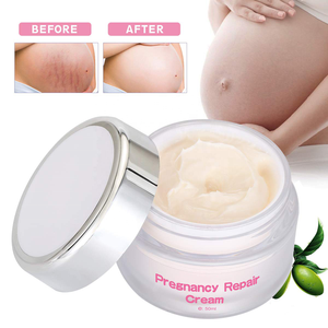 <span class=keywords><strong>Crema</strong></span> <span class=keywords><strong>per</strong></span> la riparazione della cicatrice della gravidanza con etichetta privata lozione biologica <span class=keywords><strong>per</strong></span> il trattamento del corpo smagliature - Product Image 1