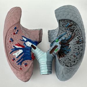 Modelo de Comparación de Ciencias Médicas: Pulmones Humanos Fumadores, Patología, Modelo de Enfermedad, Modelo de Enfermedad Orgánica, Modelo Antidrogas - Product Image 3