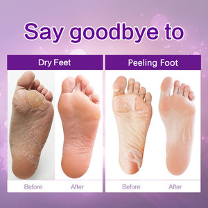 Meilleure hydratation efficace de la peau morte masque de pied peeling spa chaussettes soins des pieds exfoliant masque de soins des pieds - Product Image 6