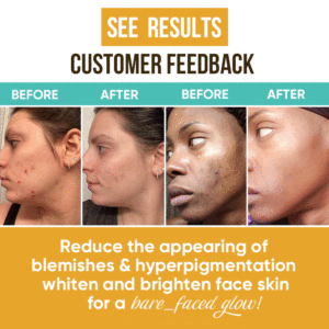 Organic Herbal Vitamin C Face Cream Anti-Aging Wrinkle Acne Remover Dark <strong>Spot</strong> Bleaching Whitening Black Skin Glycerin Main - Product Image 4