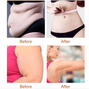 Trung Quốc điêu khắc chống cellulite huyết thanh bụng chất béo giảm béo Huyết thanh làm săn chắc sửa chữa sau sinh vết rạn da huyết thanh OEM customizaiton - Product Image 5