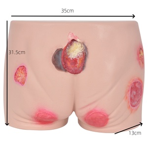 Modello in Plastica <span class=keywords><strong>di</strong></span> Ulcera del Sedere con Molteplici Tipi <span class=keywords><strong>di</strong></span> Ferite per Simulazione <span class=keywords><strong>di</strong></span> Addestramento Medico, <span class=keywords><strong>Educazione</strong></span> su Ulcere da Pressione <span class=keywords><strong>e</strong></span> Infermieristica - Product Image 6