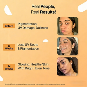 ओएम/ओडम ग्लूटाथियोन फेयरवेसेंट टैबलेट पूरक में विटामिन cand ई त्वचा को सफेद करने और त्वचा के नवीनीकरण का समर्थन करता है - Product Image 3