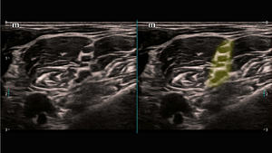 Sistem USG Diagnostik Doppler Warna 3D 4D Berkualitas Tinggi Mindray TEX20 Buatan China untuk Penggunaan Hewan - Product Image 6