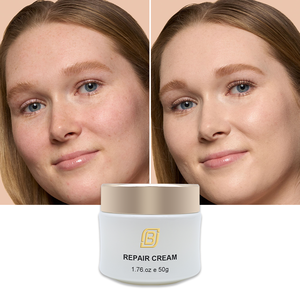 OEM/ODM Crème réparatrice barrière de haute qualité avec céramide et peptides pour peaux abîmées et sensibles rétablit l'équilibre de l'humidité - Product Image 1