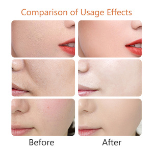 <span class=keywords><strong>Baume</strong></span> hydratant au miel et au suif, vente chaude, réparation en profondeur des peaux sèches et gercées, hydratation longue durée, restauration de la barrière cutanée - Product Image 5