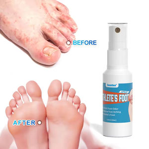 Desodorante Antihongos Herbal en Aerosol de 30 ml con Vitamina C para el Pie de Atleta, para Alivio del Dolor y Uso Sanitario - Product Image 4