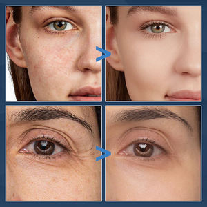 フェイスパラベンフリーの保湿剤に最適なナイトクリームは、ヒアルロン酸コエン酵素<span class=keywords><strong>Q10</strong></span>フェイスブライトニングクリームを若返らせます - Product Image 5