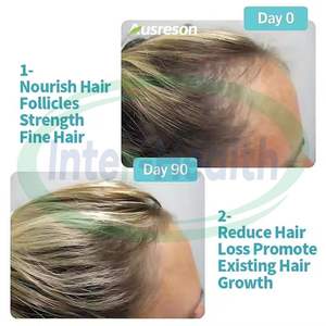 Tabletas para la Salud del Cabello OEM ASAP, Suplemento para Promover el Crecimiento del Cabello, Tabletas Avanzadas para el Crecimiento del Cabello - Product Image 2