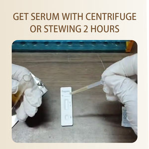 소 소 28 일 임신 테스트 키트 혈청 주사기 혈액 수집 튜브 수의학 동물 제품 신속 테스트 - Product Image 5