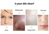 Appareil de beauté pour le visage à l'oxygène et à l'hydrogène 8 en 1, vente chaude, jet d'oxygène, peeling, rajeunissement, petit appareil à bulles