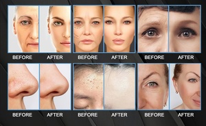Appareil de rajeunissement de la peau du visage à microdermabrasion et jet d'oxygène 8 en 1 avec 8 poignées, usage commercial, prise US - Product Image 6