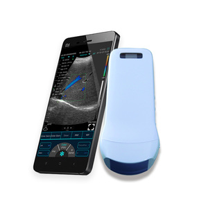 3 trong 1 konted MDR không dây siêu âm đầu dò siêu âm DOPPLER màu máy siêu âm cho toàn bộ cơ thể - Product Image 3
