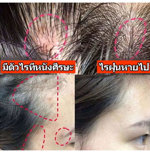 OEM Private Label 200ml Haarwuchsöl Haarvitalitäts-Booster Kopfhaut-Reparatur Kräuter-Rosmarin Haarwuchsöl Sanftes Haarwuchsöl - Product Image 3