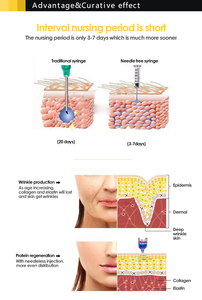 Bolígrafo de Ácido Hialurónico Más Vendido, 0.3ml/0.5ml, Recargable, Portátil, Seguro y Eficiente, para Uso Doméstico y Comercial - Product Image 3