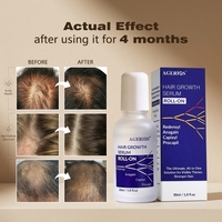 Sérum capillaire Capixyl Redensyl cliniquement prouvé, traitement de repousse rapide des cheveux, 12 semaines, essence anti-chute de cheveux, OEM