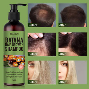 Batana <span class=keywords><strong>Shampooing</strong></span> pour la croissance des cheveux naturels <span class=keywords><strong>Shampooing</strong></span> réparateur endommagé à l'huile capillaire - Product Image 5