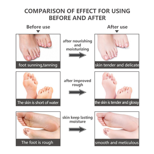 Productos Personalizados para el Cuidado de los Pies, Mascarilla Exfoliante Renovadora de Aloe Vera Orgánico, <span class=keywords><strong>Botines</strong></span> Exfoliantes Hidratantes de Lavanda - Product Image 4