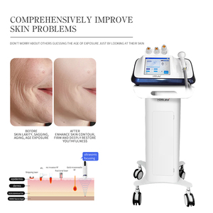 Appareil de beauté facial de bureau - Machine raffermissante pour le resserrement de la peau et le traitement <span class=keywords><strong>anti</strong></span>-<span class=keywords><strong>rides</strong></span> - Thérapie chaude et froide - Matériel plastique - Product Image 5