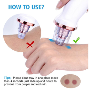 Yi Er Dụng Cụ Hút Máy Làm Đẹp Sạc Được 5 Trong 1 USB Máy Hút Lỗ Chân Lông Bằng Điện Máy Hút Mụn Đầu Đen - Product Image 6