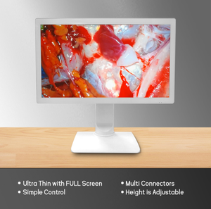 <span class=keywords><strong>TUYOU</strong></span> 32 Pulgadas 4K UHD Monitor Médico Endoscópico de Alta Definición Nuevo Diseño para Cirugía Equipo de Imágenes Médicas - Product Image 3