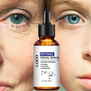 Suero Facial Personalizado de Fábrica con Logotipo Privado, Cuidado Facial con Vitamina C, Ácido Hialurónico y Retinol - Product Image 6