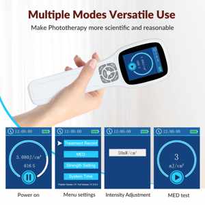 Uv terapi cahaya Ultraviolet solusi efektif tinggi 308nm Excimer Uvb Laser Vitiligo dan perawatan untuk gangguan kulit - Product Image 3